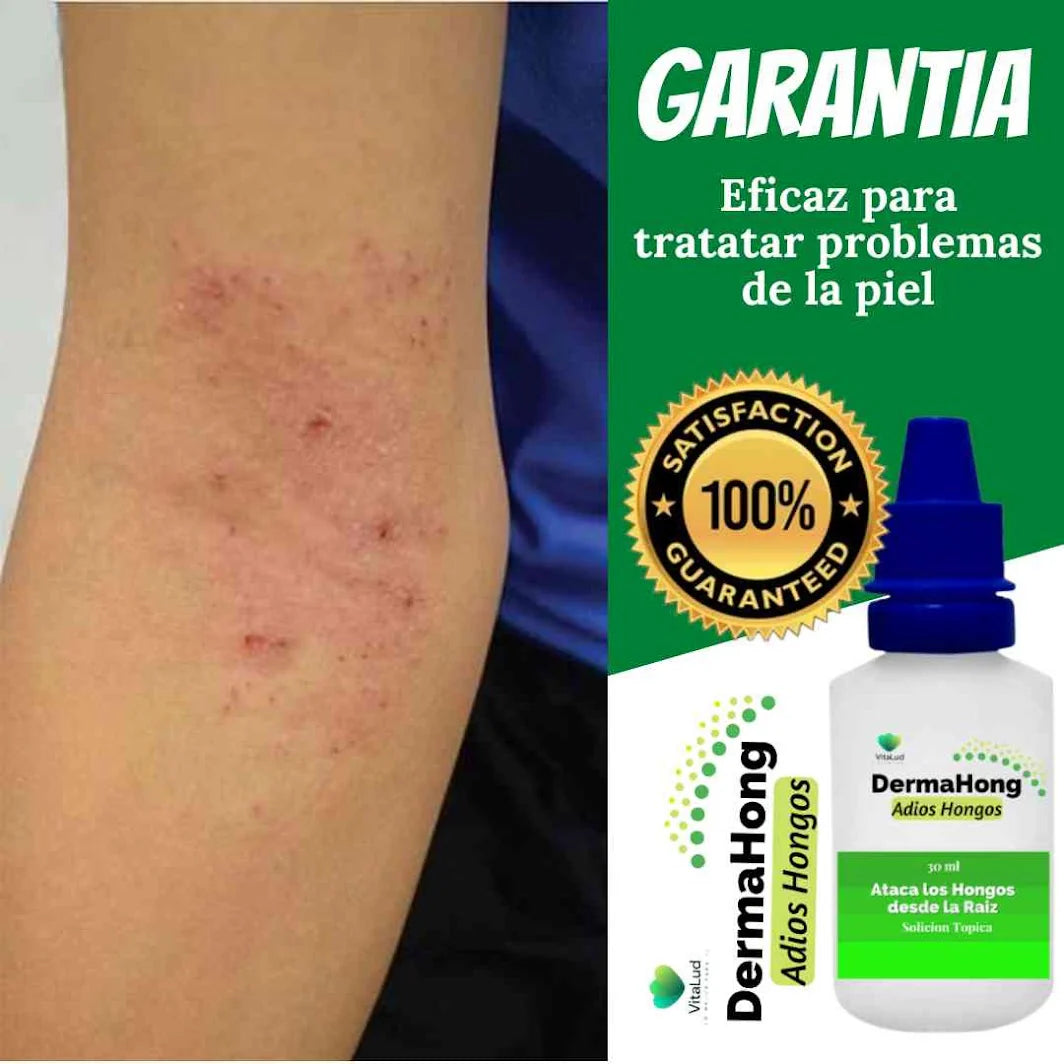 📋 Clínicamente Probado: DermaHong Elimina los Hongos Desde la Primera Semana