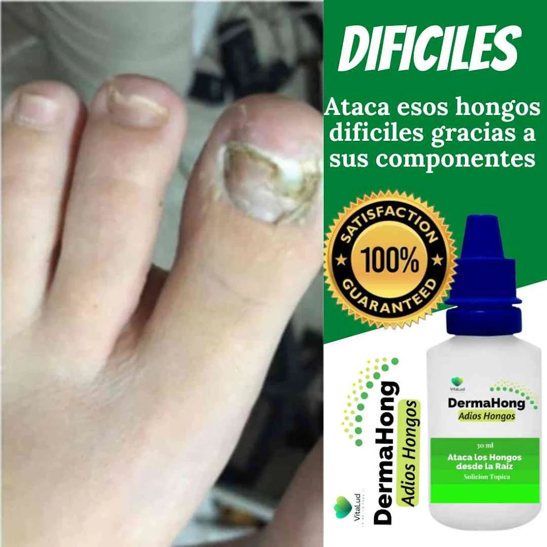 📋 Clínicamente Probado: DermaHong Elimina los Hongos Desde la Primera Semana